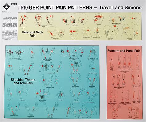 trigger points of pain wall charts set of 2 Doc